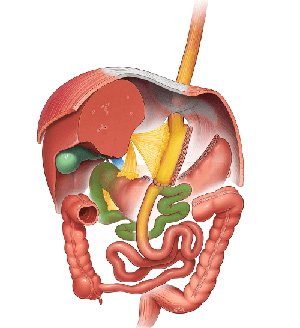 Mini Gastric Bypass